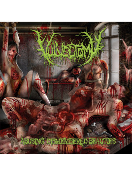 Vulvectomy - "Abusing...