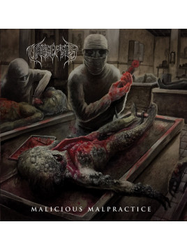 Urosepsis - "Malicious...